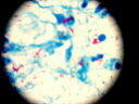 結核菌画像1