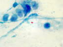 結核菌画像2