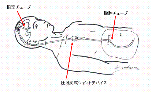 手術図解